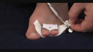 Tips For Buying A Toe Digit Wrap  MYFOOTSHOPCOM [upl. by Older]