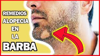 quotLa solución a la alopecia en la barba 6 remedios caseros para probar hoy mismoquot [upl. by Tavish]