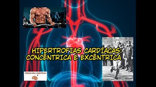 DIFERENÇAS ENTRE AS HIPERTROFIAS CARDÍACAS CONCÊNTRICA E EXCÊNTRICA [upl. by Karilynn]