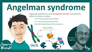 Angelman syndrome  Molecular basis of Angelman syndrome pathology amp genetics of Angelman syndrome [upl. by Roshan]