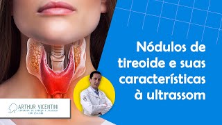 Nódulos de tireoide e suas características à ultrassom  Dr Arthur Vicentini CRM 154086 [upl. by Brandwein]