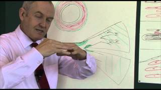 Heart disease 6 Pathophysiology of coronary heart disease [upl. by Rasec]