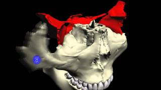 要の蝶 蝶形骨周辺の骨 Bone around Sphenoid bone [upl. by Enila]