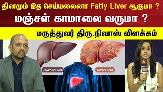 தினமும் இத செய்யலைனா Fatty Liver ஆகுமா  மஞ்சள் காமாலை வருமா   Health  Jaundice  N18V [upl. by Lynnelle]