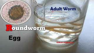 Adult Roundworm and its Egg Demonstration [upl. by Kirat253]