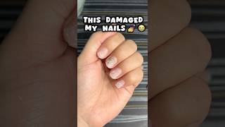 Nail extensions ki galti 😭😭nails nailsextension viralvideo shortsfeed viralshort trending [upl. by Arhez]