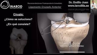 Rehabilitación de ligamentos cruzados de la rodilla [upl. by Nahn195]