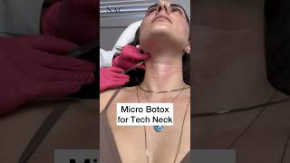 Micro Botox for Tech Neck botox microbotox beauty [upl. by Robaina]