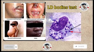 Leishmania parasiteLD bodies test part part1 leishmaniasis diseaseprotozoa in Pashto [upl. by Greta767]