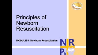 Principles of Newborn Resuscitation [upl. by Nidraj328]