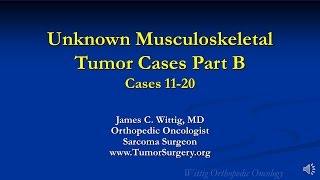 Orthopedic Oncology Course  Unknown Test Cases Part B Cases 1120  Lecture 12 [upl. by Ajssatsan]