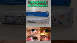 Neosporine  Neosporine antibiotic ointment  Medicine for eye infections shorts [upl. by Puto56]