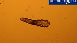 Nużeniec ludzki  Demodex folliculorum [upl. by Herring]