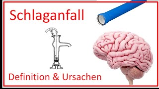 Schlaganfall  Definition und Ursachen [upl. by Eissirhc]