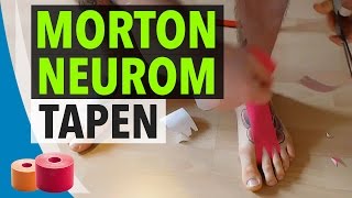 MORTON NEUROM TAPEN  Kinesiologie Tape Anleitung für Morton Neurom [upl. by Siari]