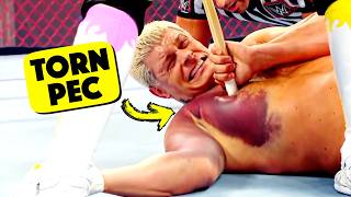 Doctor Reacts To Painful WWE Injuries [upl. by Shannen415]