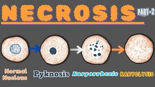 “Nuclear Metamorphosis Exploring Pyknosis Karyorrhexis and Karyolysis” Necrosis part 2 [upl. by Gomer]