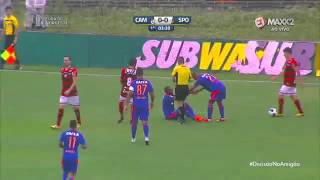 CAMPINENSE 1 3 x 1 0 SPORT  SEMIFINAL DA COPA DO NORDESTE 2016 [upl. by Suiravat]