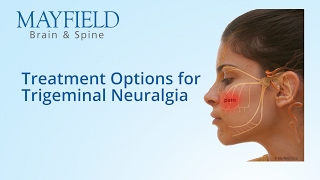 Facial Pain Treatment Treatment Options for Trigeminal Neuralgia [upl. by Jotham]