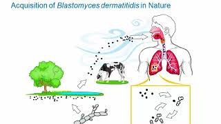 Dimorphic Fungi Blastomycosis Hot Topic [upl. by Aicemed373]