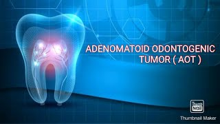 AOT  ADENOMATOID ODONTOGENIC TUMOR  Adenoameloblastoma [upl. by Heins]