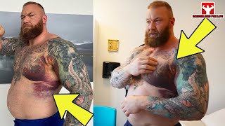 THOR UGLY INJURY Tear his Lower Pec  Hafthor Bjornsson [upl. by Sternick]