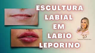 TÉCNICA DE CORREÇÃO DO LÁBIO LEPORINO  Método Escultura labial [upl. by Alekim]