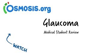 Glaucoma  Clinical Presentation [upl. by Ziladnerb]