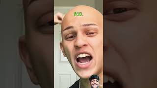 l get eyebrow finally  comedy funny alopecia makeup shortstrending funnyshorts [upl. by Orutra]