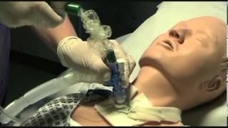 Closed suction of a tracheostomy tube [upl. by Suhpoelc414]