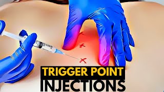 The Anatomy of Pain Relief A Look at Trigger Point Injections [upl. by Eimor]