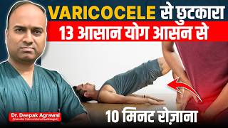 Cure Varicocele With Yoga and Exercises at Home  Varicocele Natural Treatment [upl. by Anytsirhc]