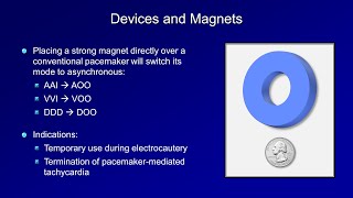 ICDs and Biventricular Pacemakers [upl. by Beret]