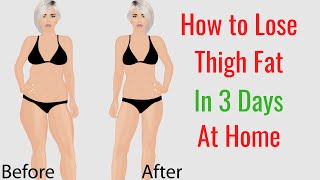 How to Lose Thigh Fat in 3 Days at Home [upl. by Frieder]