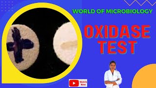 Oxidase Test Tamil  Cytochrome Oxidase  Identification of Bacteria by Biochemical Test [upl. by Odracer]