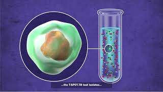 What is the TSPOTTB test [upl. by Elliot]