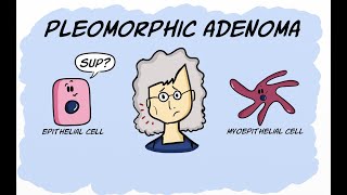 Pleomorphic Adenoma [upl. by Genesa]