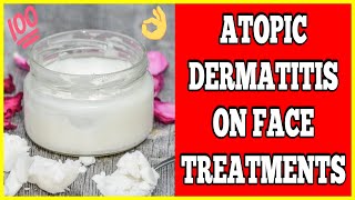 Atopic Dermatitis On Face  Atopic Dermatitis On Face Treatments [upl. by Melar]