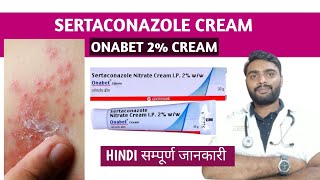 Sertaconazole cream in hindi  Onabet cream  Sertaconazole ointment [upl. by Udelle]