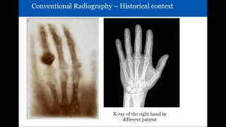 Introduction to Radiology Conventional Radiography [upl. by Markos]