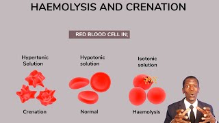 Preventing Hemolysis in the Blood Samples You Draw [upl. by Lorenzo]