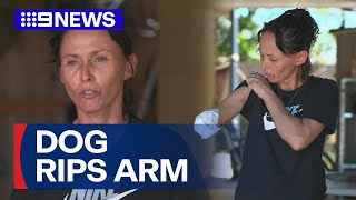 Mum says she doesnt blame her dog after it ripped her arm off  9 News Australia [upl. by Ahcsropal]