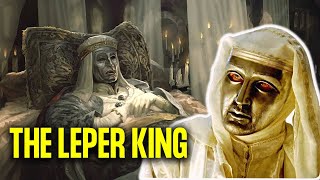 What Really Happened To The Leper King  Baldwin IV of Jerusalem [upl. by Noram]