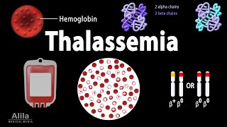 Thalassemia Alpha amp BetaThalassemias Genetics Pathophysiology Diagnosis amp Treatment Animation [upl. by Klatt134]