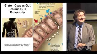 MD Alessio Fasano  Gluten is like a bacteria [upl. by Salman]