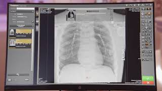 CARESTREAM Image Suite Software with DRXDetector Xray Imaging [upl. by Leerzej245]