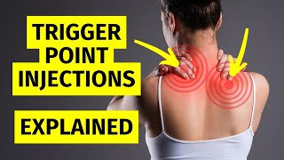 Myofascial Pain Trigger Point Injections Explained [upl. by Edals]