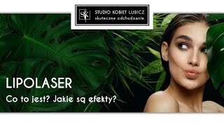 Lipolaser co to jest Jakie są efekty zabiegu [upl. by Andree]