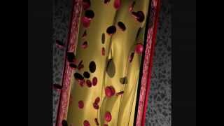 vidéo sur la formation dune thrombose [upl. by Theta389]