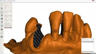 Advance Virtual Tooth Extraction [upl. by Milzie]